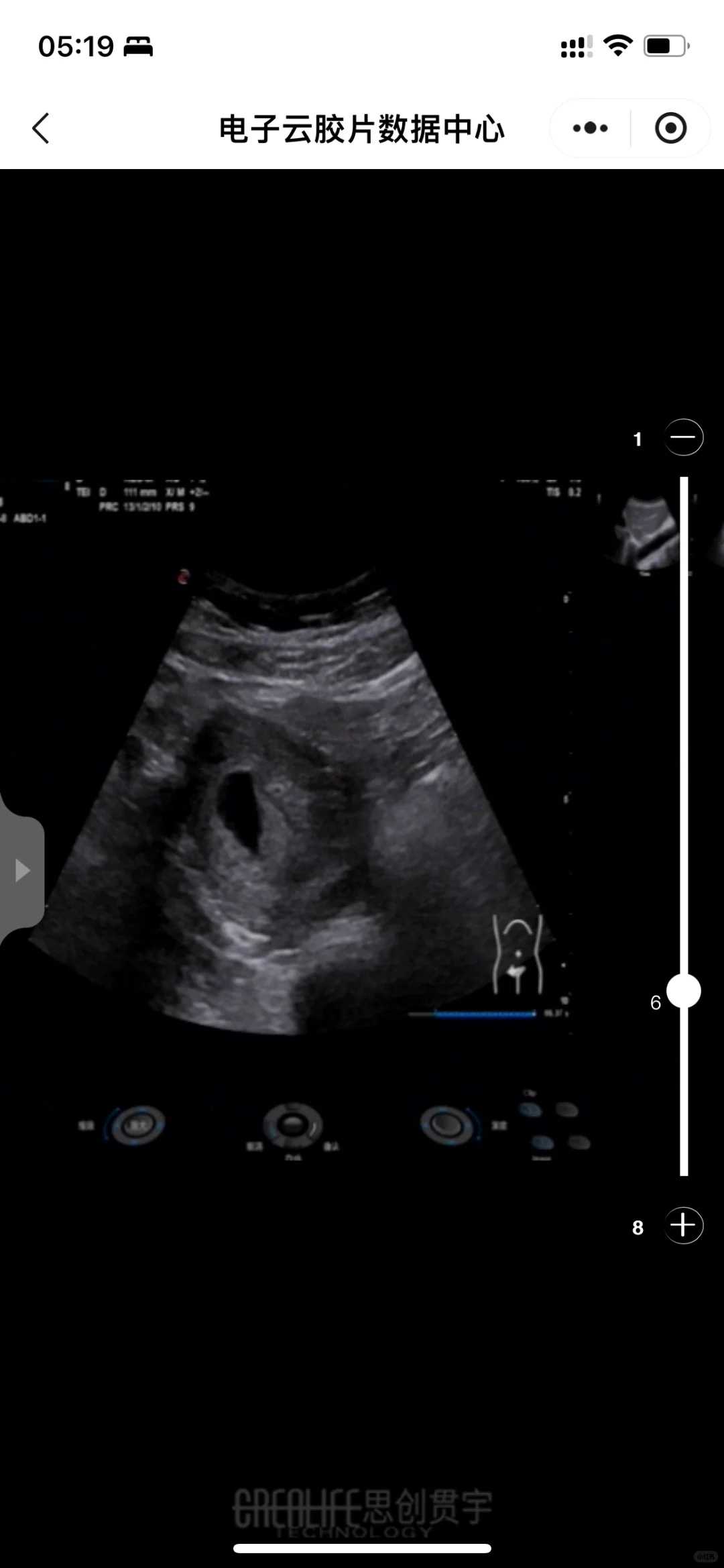 郑州山上放生（郑州净土放生简单仪轨视频）