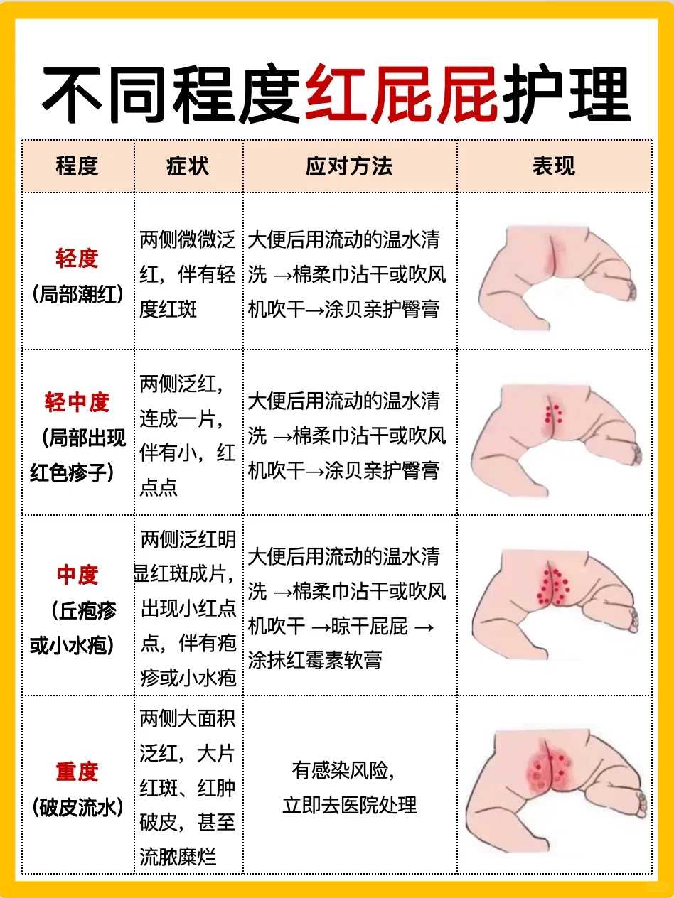 小鸟放生温州壁虎放生在哪比较好【温州哪里放生比较好】