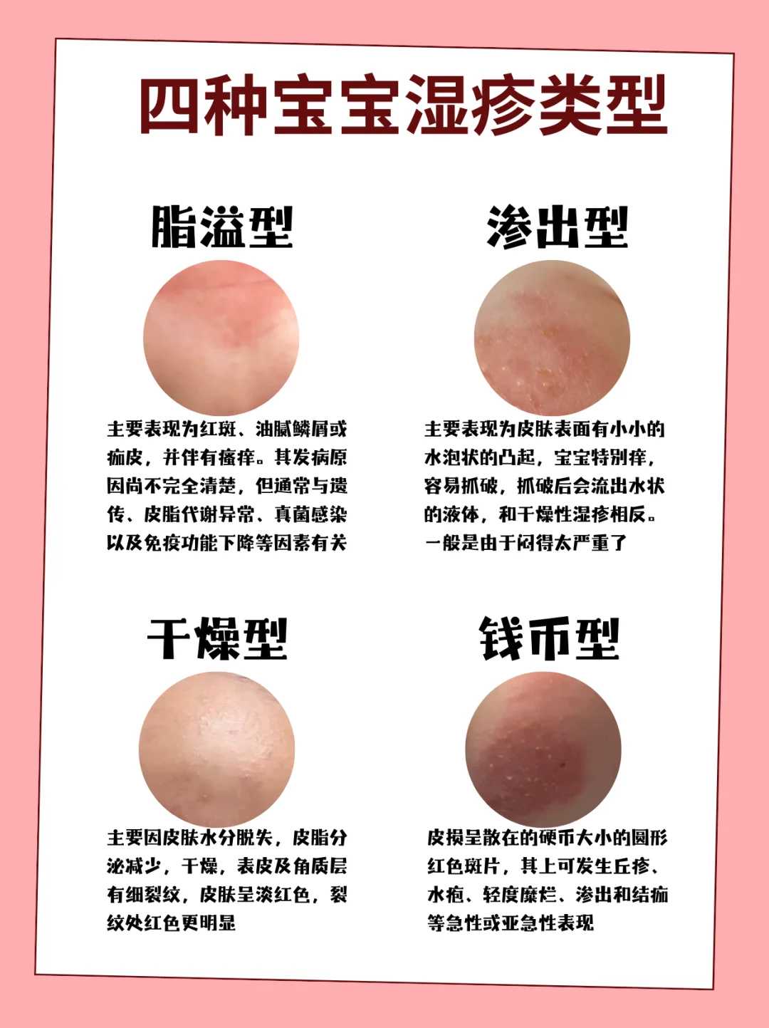 无锡代放生团鱼的方法，甲鱼放生到哪里最安全